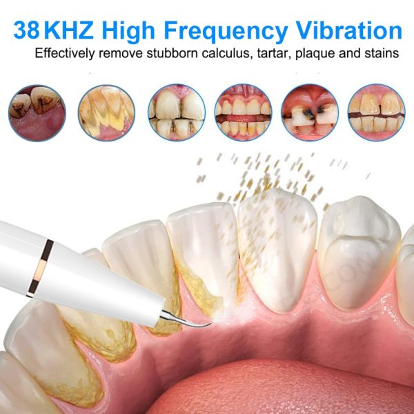 Ultrasonic Dental Scaler For Teeth Tartar Stain Tooth Calculus Remover Electric Sonic Teeth Plaque Cleaner Dental Stone Removal – Oral Irrigator 2